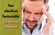 เส้นเลือดสมองตีบ